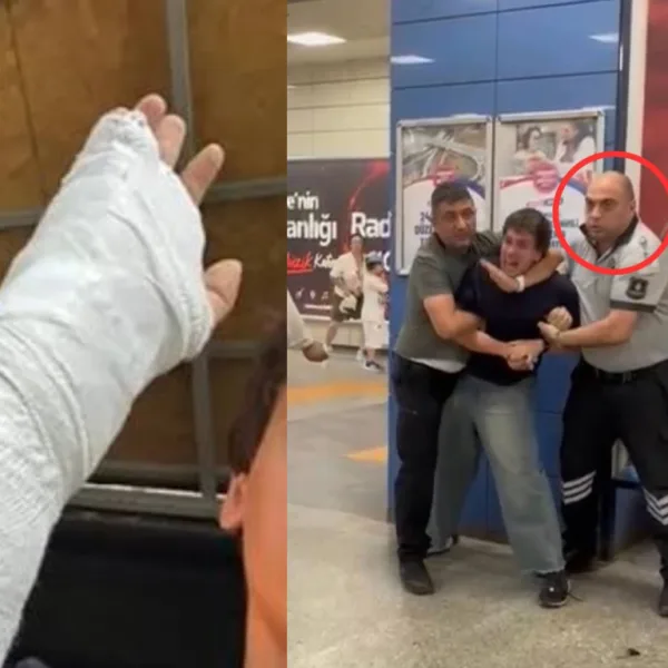 NATO’yu Protesto Etmeye Giden Gencin Kolunu Metro Güvenliği Kırdı